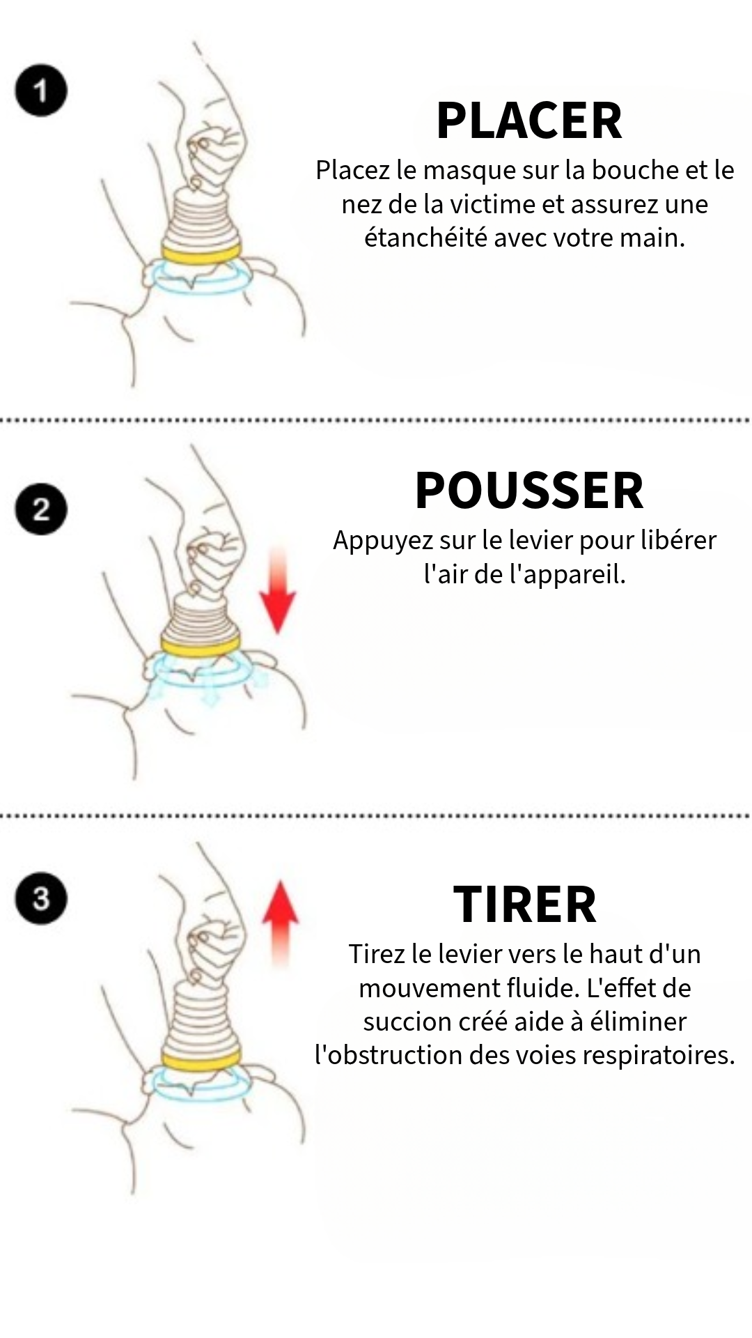 Dispositif Anti-Étouffement d'Urgence