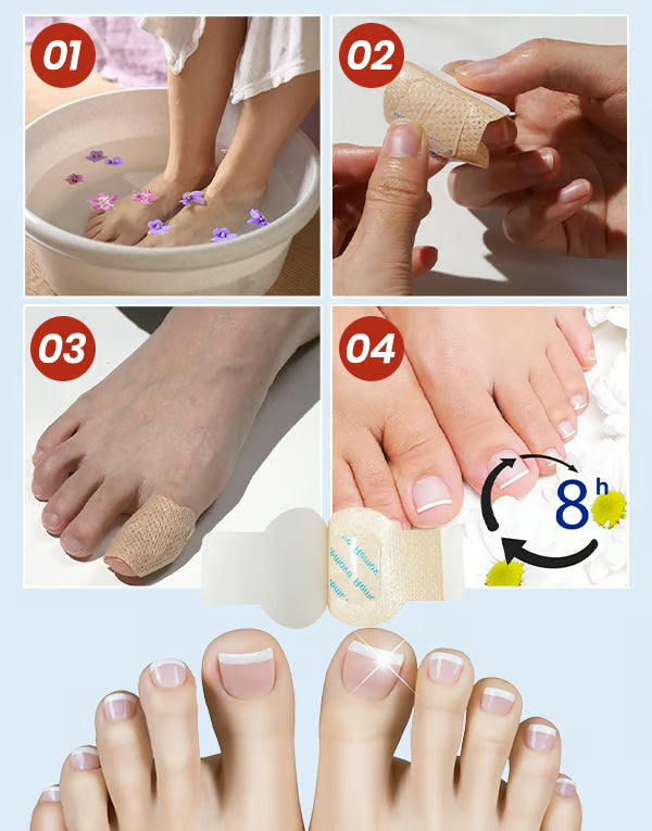 Anti-Moisissure Patches pour Ongles