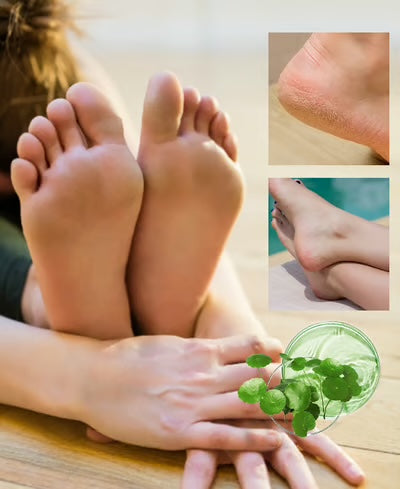 Spray Anti-Callosités pour les Pieds