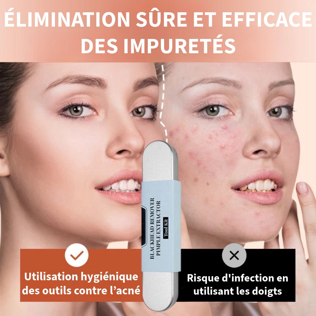 Kit d’Extraction en Acier Inoxydable pour Points Noirs