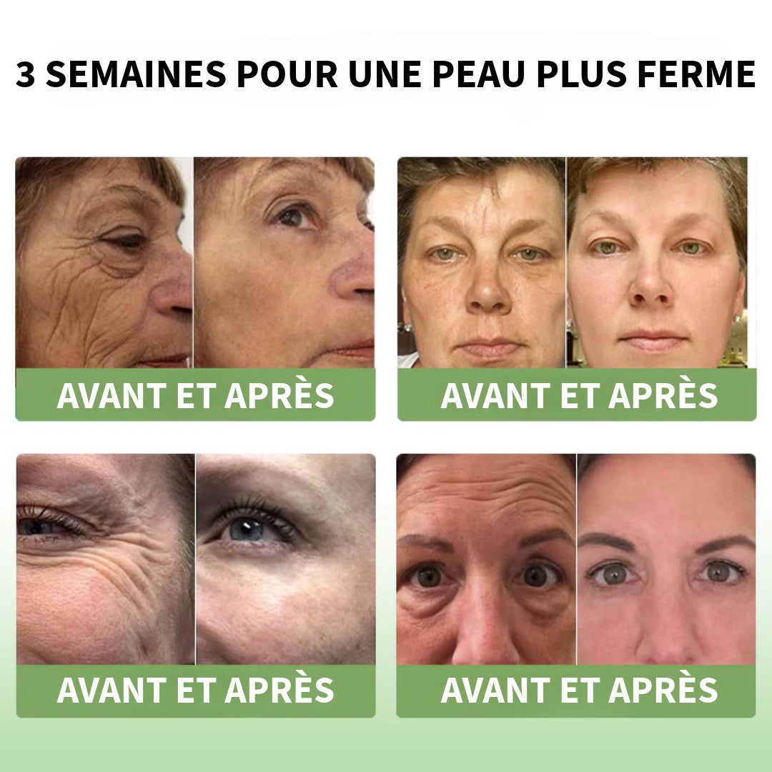 Crème Collagène