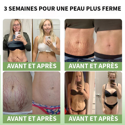 Crème Collagène