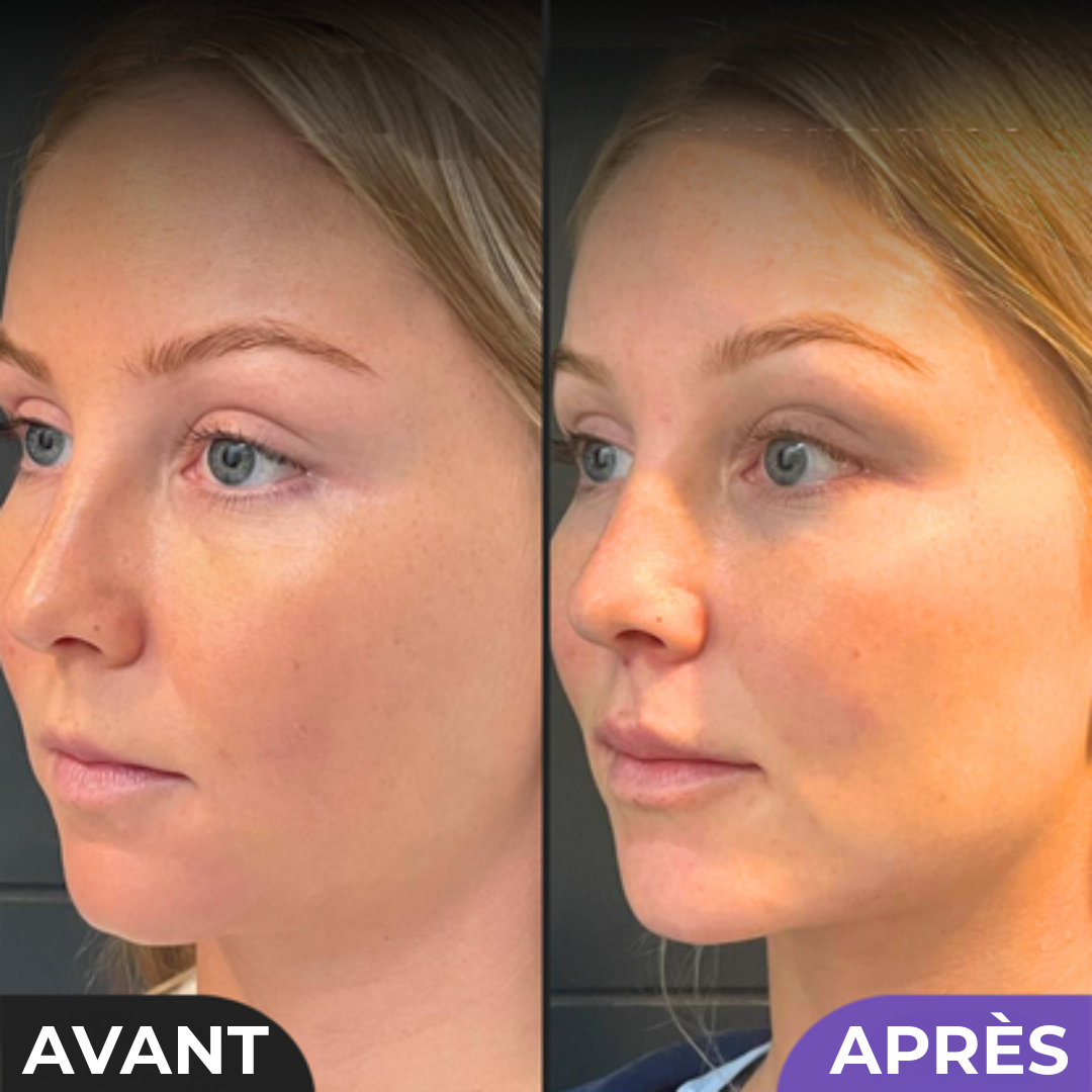 Shaper de Beauté Professionnel